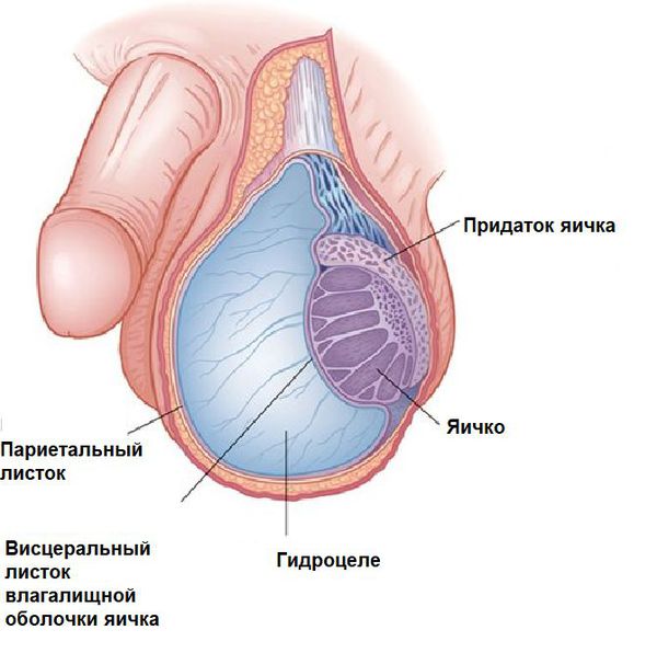 Болезни яичек, органов мошонки у мужчин